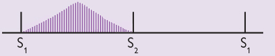 Graph: an ejection systolic murmur 